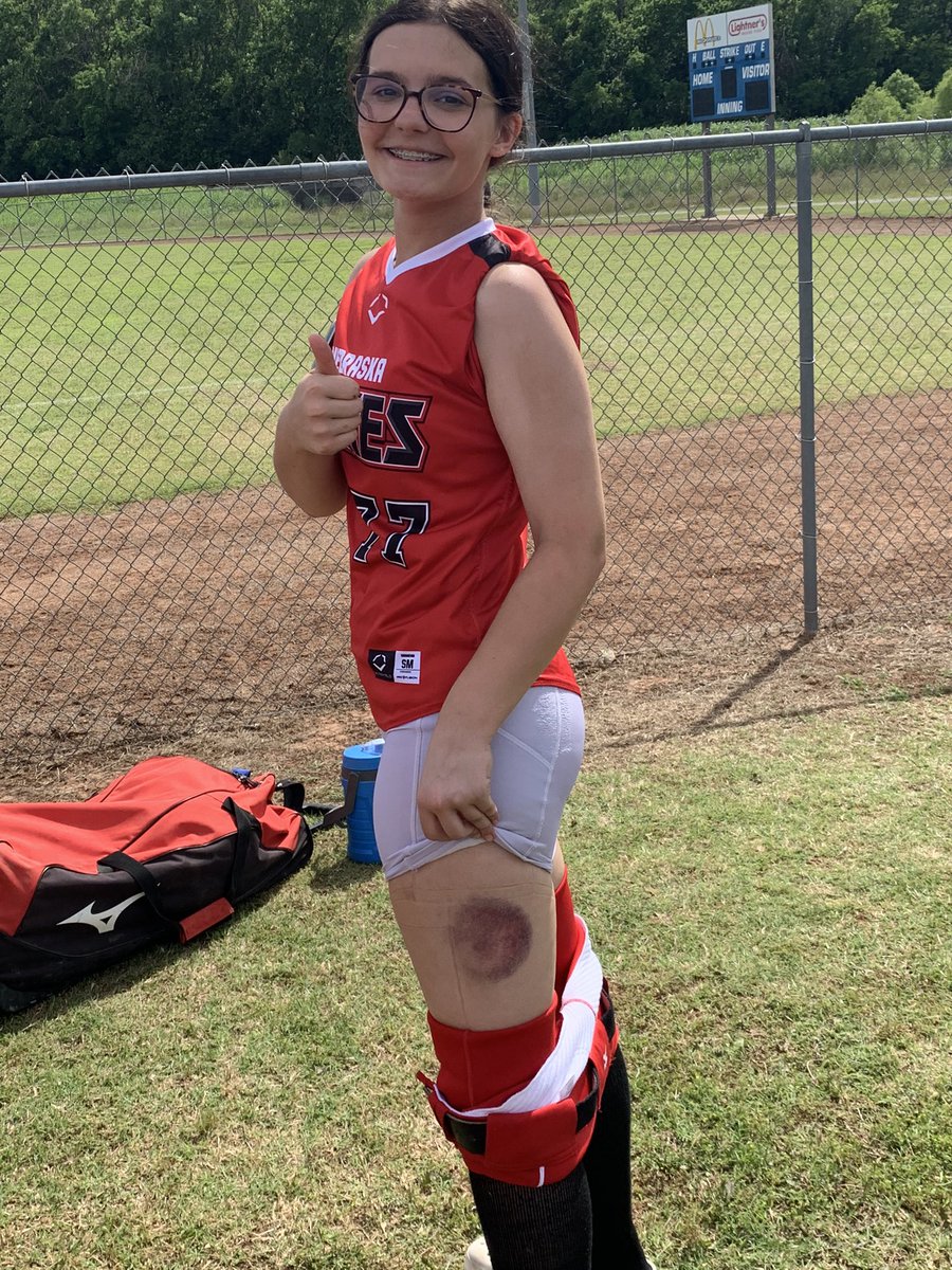 Battle wound for the weekend! Way to take one for the team Avery.