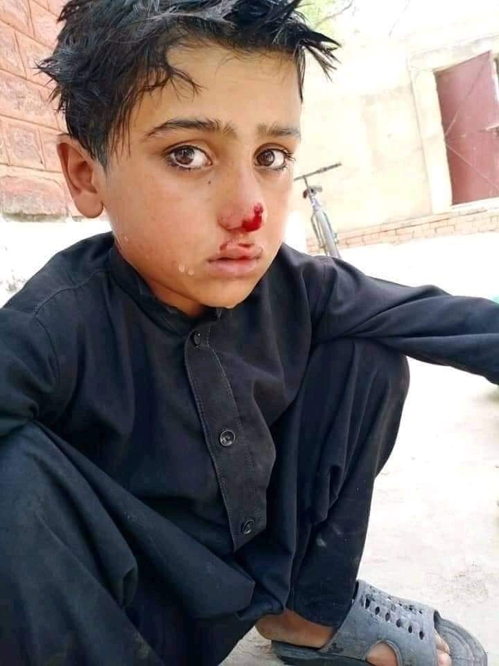 DsdDte's tweet photo. یہ اگر کسی وزیر کے بچے ہوتے تو ان کو احساس ہوتا ہے کہ گرمیوں کی چھٹیاں گرمی کی شدت کی وجہ سے ہوتی ہیں۔
اب کس چیز کا انتظار کیا جارہا ہے, چھوٹے بچوں پر رحم کرو۔
@DrMuradPTI 
@Shafqat_Mahmood 
@UsmanAKBuzdar 
@Asad_Umar 
@ImranKhanPTI 
@Dr_YasminRashid https://t.co/s4gyC5USnj