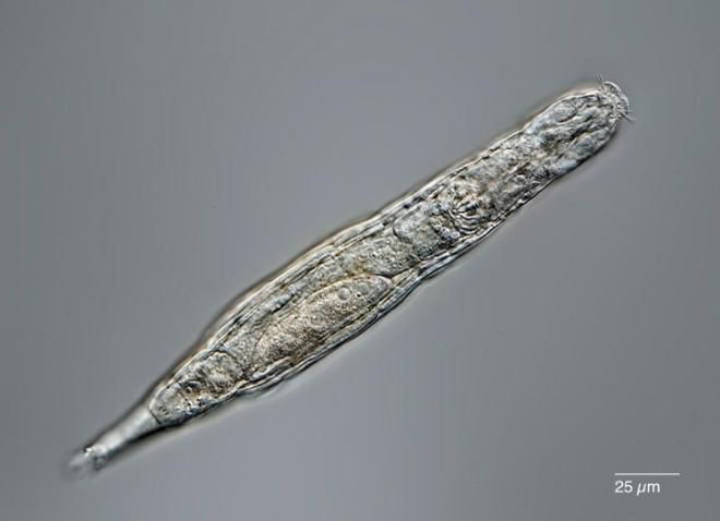 trantanit's tweet image. Với nhiều người, ngủ đủ 8 tiếng đã được coi là nhiều. Nhưng một loài động vật siêu nhỏ ở Bắc cực đã trải qua giấc ngủ có thời gian tới 24.000 năm và vừa mới thức tỉnh. Đó là loài luân trùng Bdelloid, một sinh vật nước ngọt cực

bao247.org/tin-cong-nghe/…