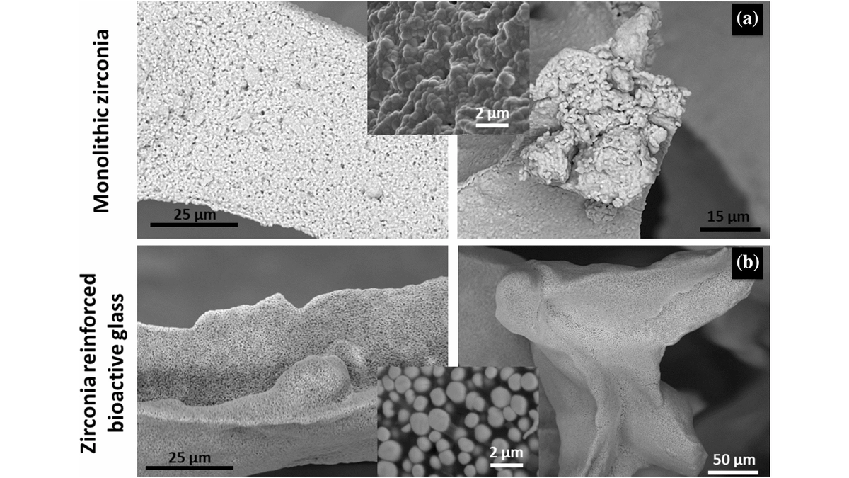JMaterSci's tweet photo. July #EditorsPick (handled by Dave Cann @OregonStateMIME)
Zirconia-reinforced bioactive glass porous structures for bone repair
from @UFSC #CERMAT #DODT #LMPT 🇧🇷 @UMinho_Oficial #CMEMS @Cespu_Ensino 🇵🇹 @UDLAEcuador 🇪🇨
https://t.co/MTuyJcupsm
#ceramics #BTE #bioglass https://t.co/k1e4cJCAK0