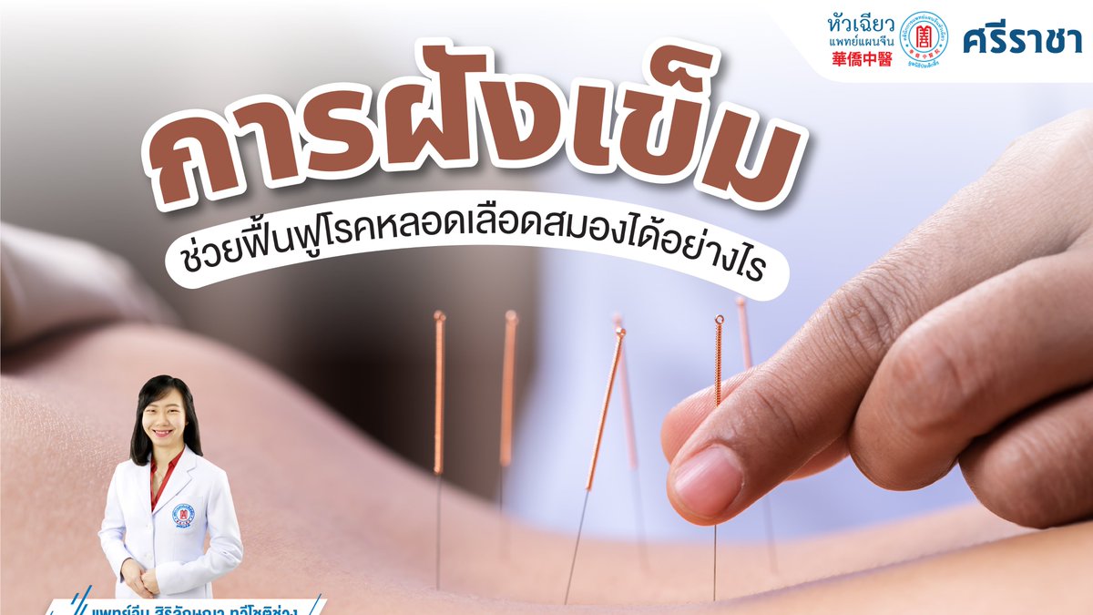 huachiewsrc's tweet photo. การฝังเข็มช่วยฟื้นฟูผู้ป่วยโรคหลอดเลือดสมองได้อย่างไร ?
ภายหลังการเกิดโรคหลอดเลือดสมองแล้วนั้น การฟื้นฟูสมรรถภาพผู้ป่วยทั้งทางด้านร่างกาย อ่านเพิ่มเติม : https://t.co/fDxCsBVLSM https://t.co/D4rtoT6h6B
