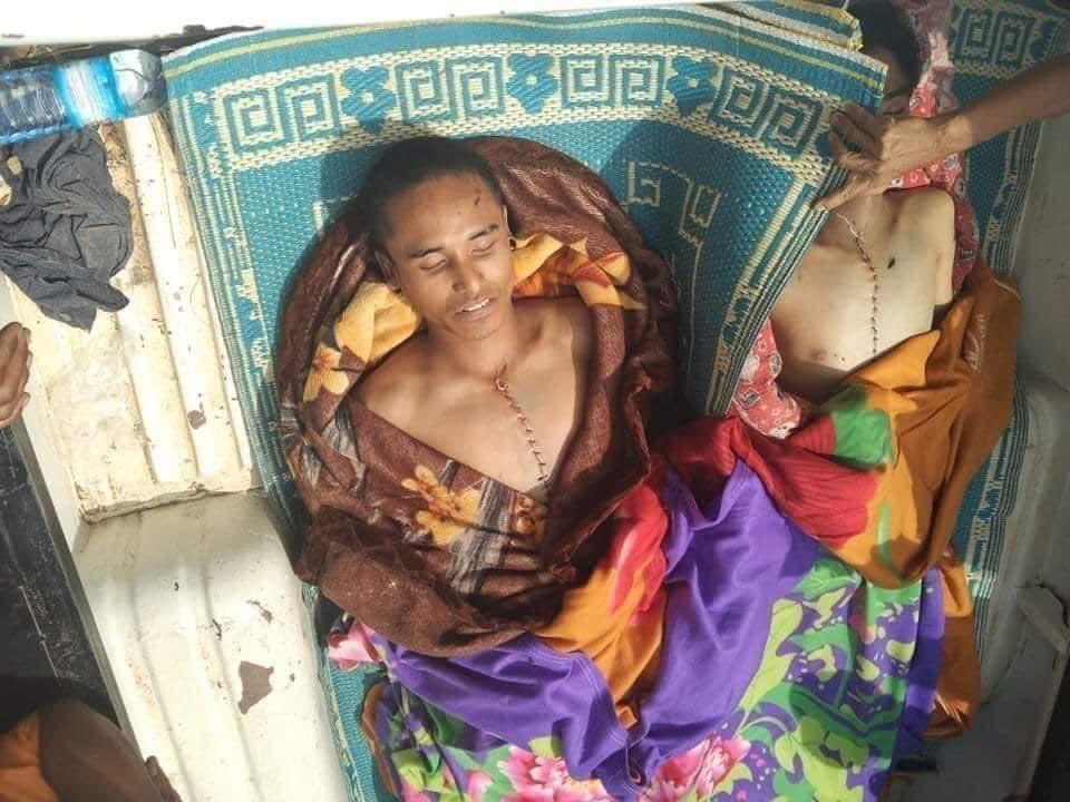 Snow_Frozenn's tweet photo. People were abducted alive and sent the bodies back after opening the chest. This is how military interrogation is behaving on its own civilians. @poppymcp @RapporteurUn @USAmbUN @clarissaward @TostevinM @MarkFarmaner @KenRoth @SAdamsR2P @YourAnonCentral #WhatsHappeningInMyanmar https://t.co/mmr4bn0fnh
