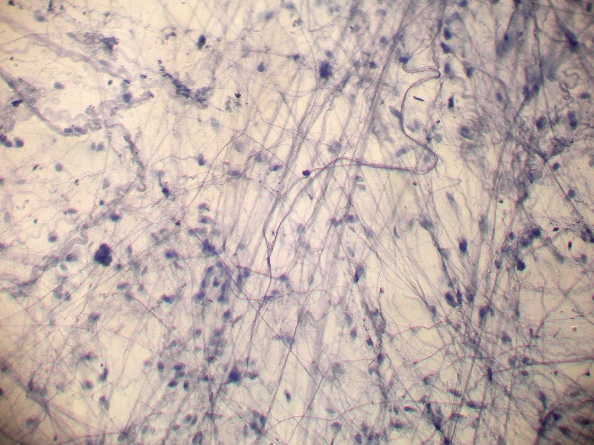 Loose Connective Tissue - Scientific Illustration