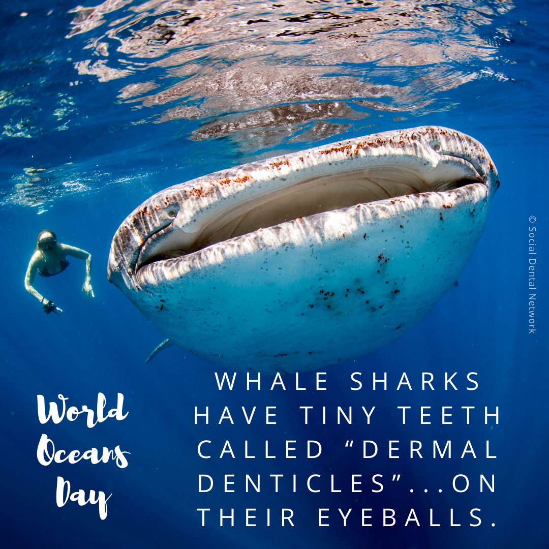 Did you know that whale sharks have teeth on their eyeballs? 👁️

#WorldOceansDay #socialdentistry