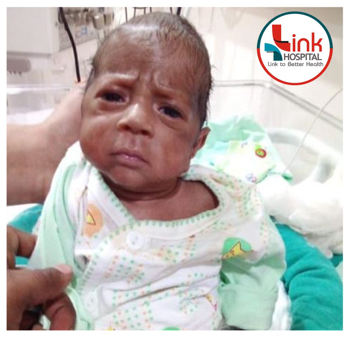 Link_Hospital's tweet photo. यह काफी कठिन परिस्थिति थी, लेकिन हमारे न्योनेटोलॉजिस्ट डॉ. अतुल गोस्वामी और नर्सो के समर्पण के कारण आज बच्चा अच्छी तरह से फ़ीड स्वीकार कर रहा है। अस्पताल के इलाज से परिजन खुश हैं। #linkhaina #link #hospital #birth #Doctors #care https://t.co/g9QL3C756s