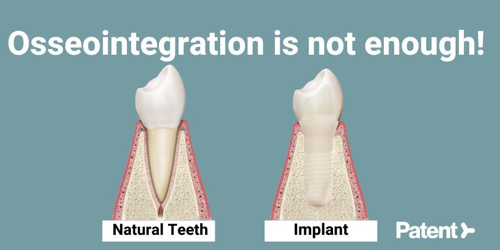 ZirconMedical's tweet photo. In the early days of #implantology there was a strong focus on osseointegration to make sure that the implants stayed in the bone for a long time. In more recent years the focus has shifted to soft tissue integration. For more info about Bio-integration: https://t.co/kmETCnIGsg https://t.co/qhrqlNYkXm