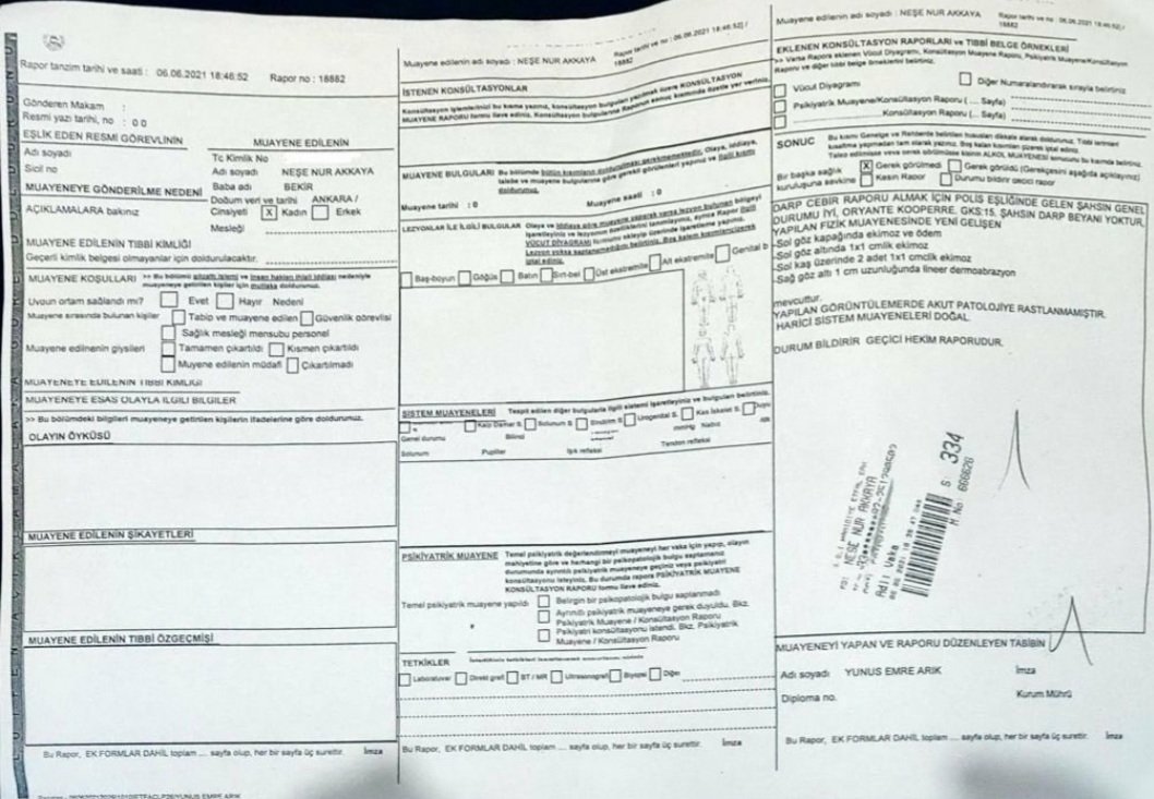 Nişantaşı'nda parkta oturan akademisyen Neşe Nur Akkaya'ya başörtülü olduğu için saldıran #ErayÇakınTutuklansın
Arkadaşlar!
Bu alçak gözaltına alınana kadar lütfen susmayın. 
#SaldırganErayÇakın