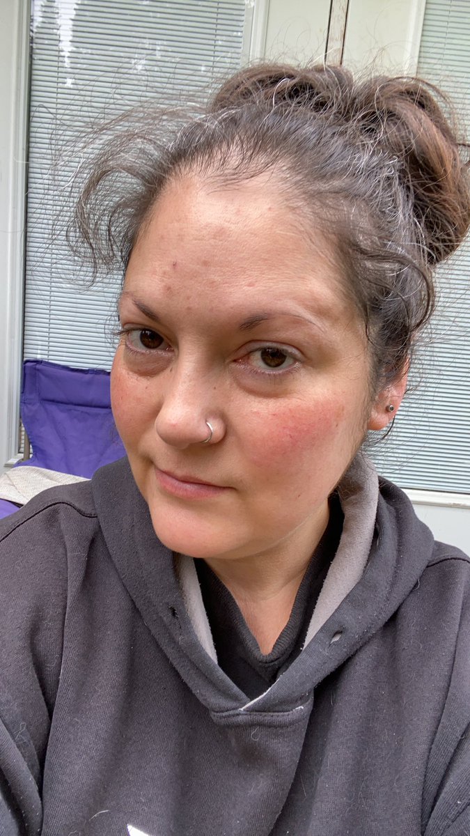 The face of burn out. Over a year of keeping my business afloat during the pandemic. Not easy. Breathe, do one thing at a time, and always remember there are those who love you. #MentalHealthMatters