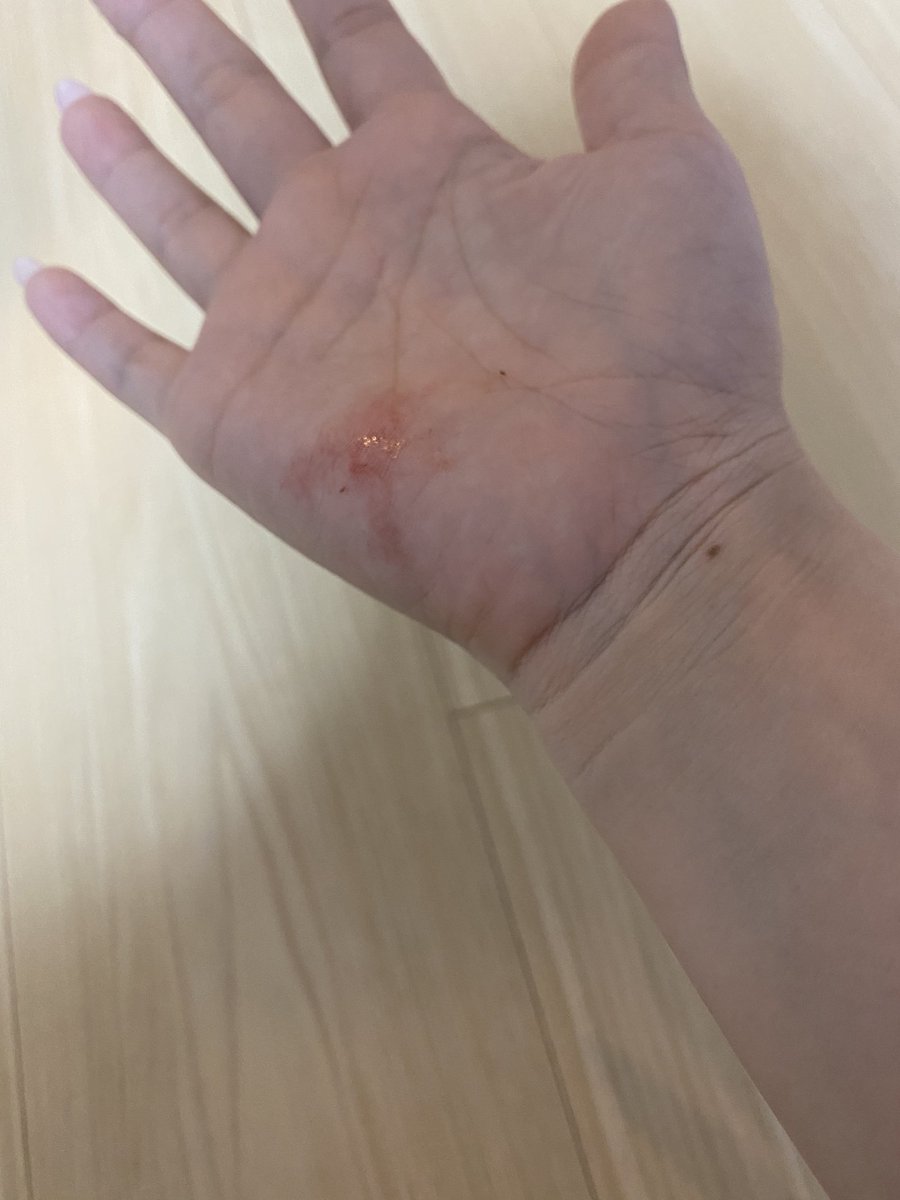 数時間前までこんな可愛い寝方してたのに今さっき💩し終わった後に抱っこしたら血がついてたんだけどどうしよう…明日すぐ病院行くけど誰か落ち着かせて欲しい😭😭😭😭病気だったらどうしよう😭😭😭😭 https://t.co/01YOWzEWCj