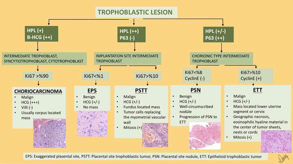 thejourneymate's tweet photo. Spectrum Of Trophoblastic Diseases In A Nutshell 🔬
https://t.co/AvxvbI1dVW https://t.co/Qa3GoJUbCa