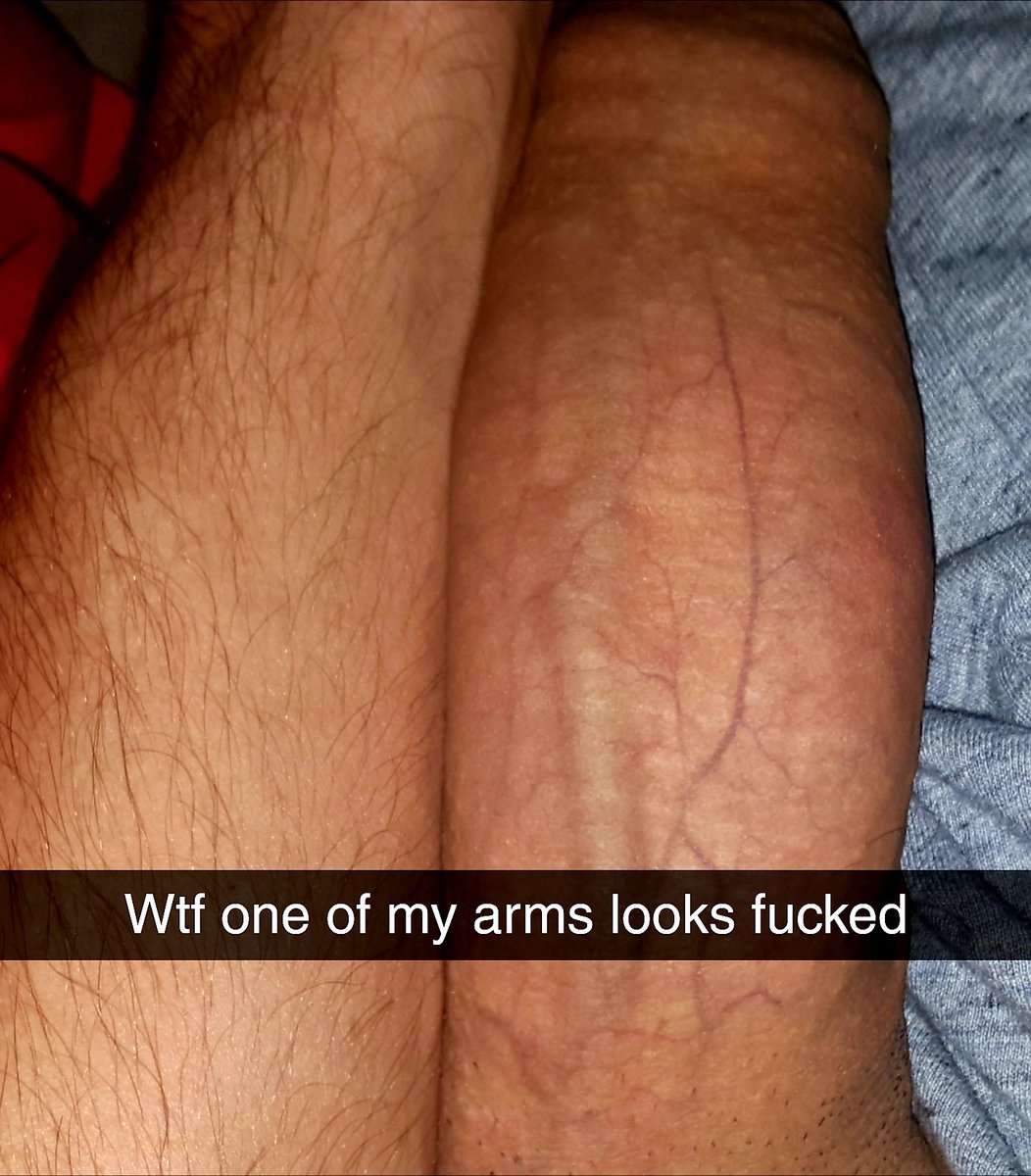 Tyler80243532's tweet photo. Hurt my arm, someone tell me if it looks OK? 🤪 #bigdick #hugecock #hung #autofellatio #self_suck https://t.co/AhWRnN6xhk