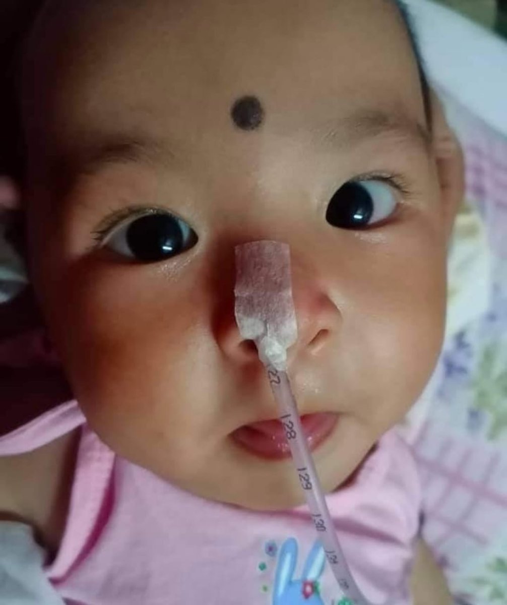 medisuxx's tweet photo. @SoodFoundation This 7months old baby Soivam Kiaan Sigha has been diagnosed with SMA Type-I, which is a really dangerous genetic disorder Zolgensma.Its cure costs ₹18cr per dosages Please help us.The link will be verified soon.https://t.co/j8Zz79FRjm https://t.co/msCZbqDlKv https://t.co/BJJbrrmM0R