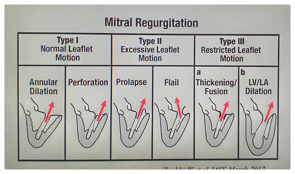 #Medtwitter #CardioPeeps #Cardiology #InterventionalCardiology #cardiovascular #Cardiologist #Cardiologists #echocardiography #echocardiographer #cardioecho #pocus #pointofcareultrasound