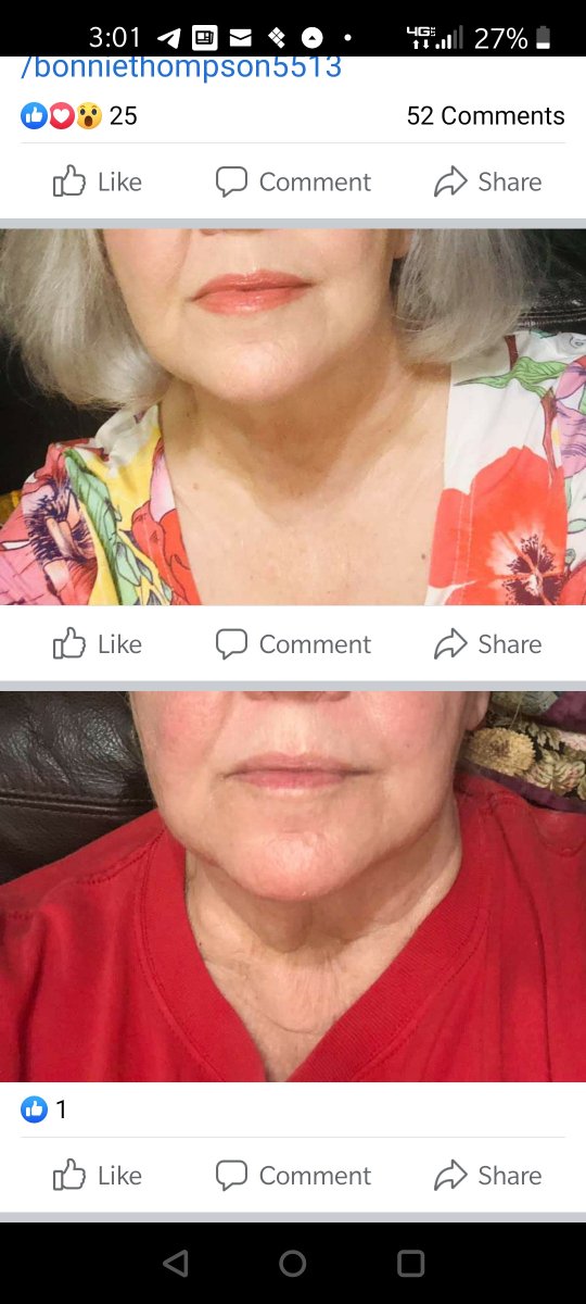 wendyhoag's tweet photo. I love what I do! One of my friends, only two weeks. Her husband noticed too and he also said I look 35. I wish! Lol regular order 80.00, but 4 bottles for 80.00. you can pick 2 nights and two firms for 80.00 https://t.co/CmF0gZVS9u