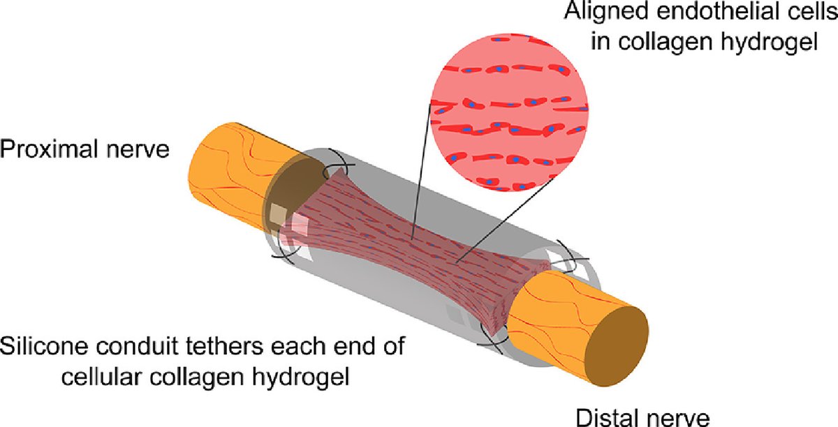 James Phillips (@phillipslab) on Twitter photo Aligned endothelial cell structures in #EngineeredNeuralTissue promote peripheral nerve regeneration. <a href="/drtanque/">Papon Muangsanit</a> <a href="/VickoirR/">Vicky R</a> <a href="/UCL_NerveEng/">UCL Nerve Eng</a> sciencedirect.com/science/articl… Aligned endothelial cell structures in #EngineeredNeuralTissue promote peripheral nerve regeneration. <a href="/drtanque/">Papon Muangsanit</a> <a href="/VickoirR/">Vicky R</a> <a href="/UCL_NerveEng/">UCL Nerve Eng</a> sciencedirect.com/science/articl…