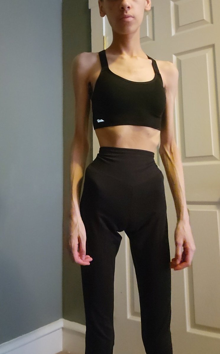 sorrowcirus's tweet photo. bodycheck (I look so chubby), any advice on how to lose weight pls #EDtwt https://t.co/Ixziu9k1bZ