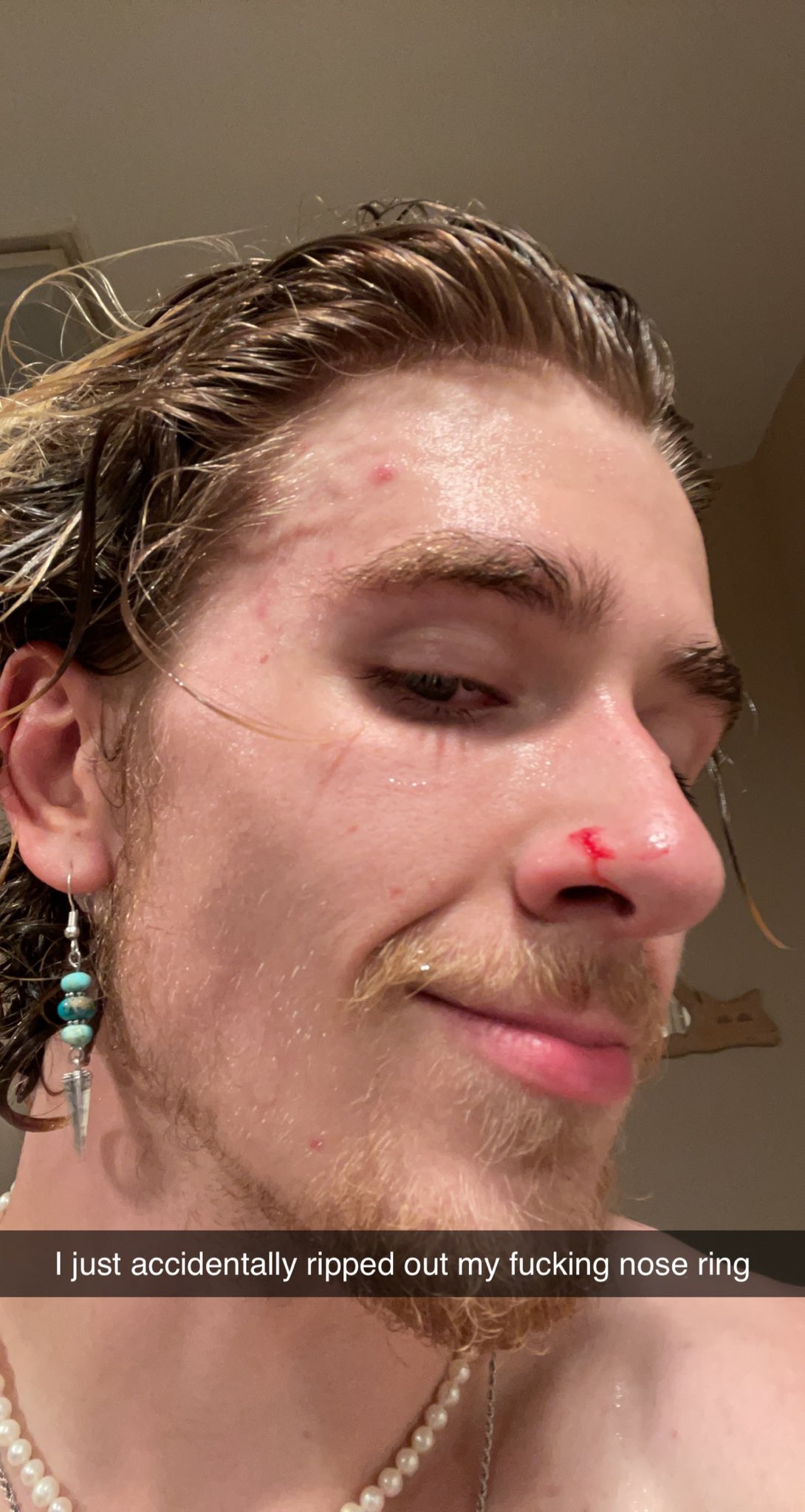 Evan Foulds on X So like I kinda ripped my fucking nose ring out last night on accident and that shit bleed forever https t iLsd2xQNfE X