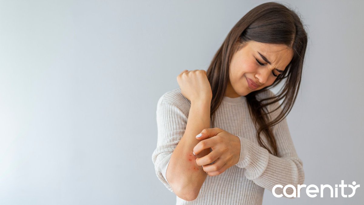 CarenityUK's tweet photo. #Psoriasis is an inflammatory skin condition affecting around 2% of people in the UK. Many are not familiar with it, so many misconceptions exist.

What are some common misconceptions about psoriasis?

We untangle the true from the false in our article! 👇
https://t.co/jSeZbWTLYL https://t.co/rCKH37UsV6