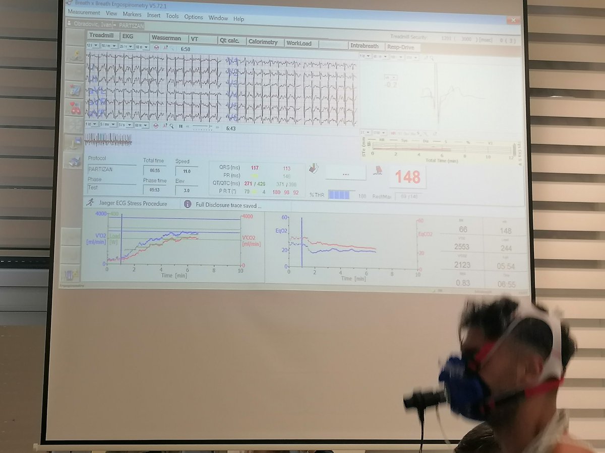 LKrzman's tweet photo. Significance of #CPET 📚👌 @FKPartizanBG in our #UniversityCentarforSportsandExerciseMedicine #besafecomeagain #laboratory #Cardiology #ECG #UCSEM #belgrade https://t.co/wTJRg8AjJn