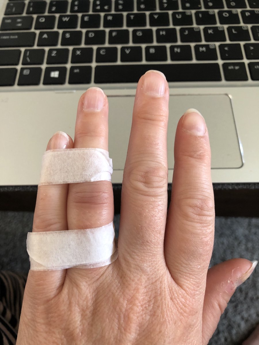 sarahwhittingh8's tweet photo. I knew sport was bad for you 🤣 Broken finger from a rounders match last night. Maybe I’m getting too old for rounders?? @drewwhitt confirmed this when he advised I start taking Adcal #cheeky #stillabletotype #middleageissues https://t.co/gLMkpXaLmf