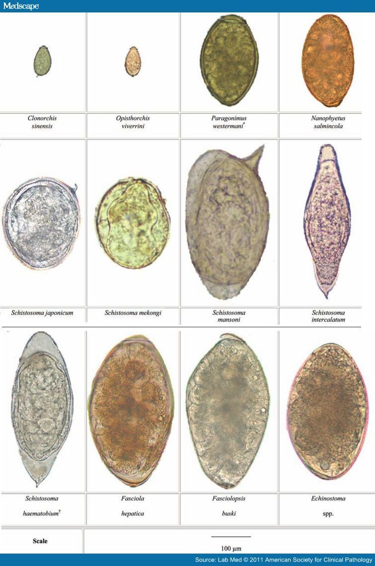 Lab_filez's tweet photo. Tremtode eggs 🥚 https://t.co/UclZVvcVGe