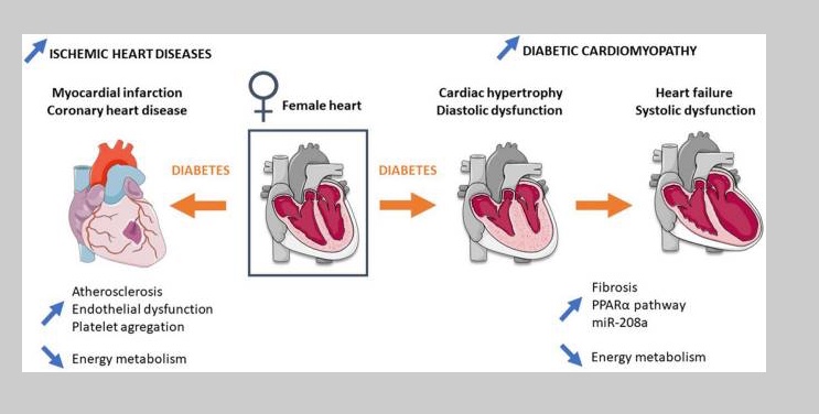 Luc Bertrand (@bertrandluc_ky) on Twitter photo The mini-review of our postdoc Natacha Fourny is now available : Sex Differences of the Diabetic Heart ncbi.nlm.nih.gov/pmc/articles/P… <a href="/GRRC_SFCardio/">GRRC -French community in cardiovascular research</a> <a href="/JeremyFauconni1/">Jeremy Fauconnier</a> <a href="/IREC_UCLouvain/">IREC - UCLouvain</a> <a href="/UCLouvain_ADRE/">UCLouvain Recherche-Research</a> The mini-review of our postdoc Natacha Fourny is now available : Sex Differences of the Diabetic Heart ncbi.nlm.nih.gov/pmc/articles/P… <a href="/GRRC_SFCardio/">GRRC -French community in cardiovascular research</a> <a href="/JeremyFauconni1/">Jeremy Fauconnier</a> <a href="/IREC_UCLouvain/">IREC - UCLouvain</a> <a href="/UCLouvain_ADRE/">UCLouvain Recherche-Research</a>