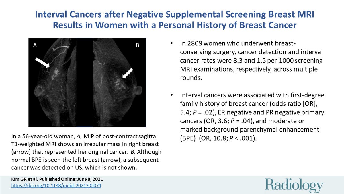 SNUH Breast (@snubreast) on Twitter photo Published in <a href="/radiology_rsna/">Radiology</a> by Prof. Nariya Cho et al!
Interval Cancers after Negative Supplemental Screening Breast MRI in PHBC women
pubs.rsna.org/doi/10.1148/ra…
<a href="/snubreast/">SNUH Breast</a> <a href="/SNU_Rad/">SNU Radiology</a> Published in <a href="/radiology_rsna/">Radiology</a> by Prof. Nariya Cho et al!
Interval Cancers after Negative Supplemental Screening Breast MRI in PHBC women
pubs.rsna.org/doi/10.1148/ra…
<a href="/snubreast/">SNUH Breast</a> <a href="/SNU_Rad/">SNU Radiology</a>