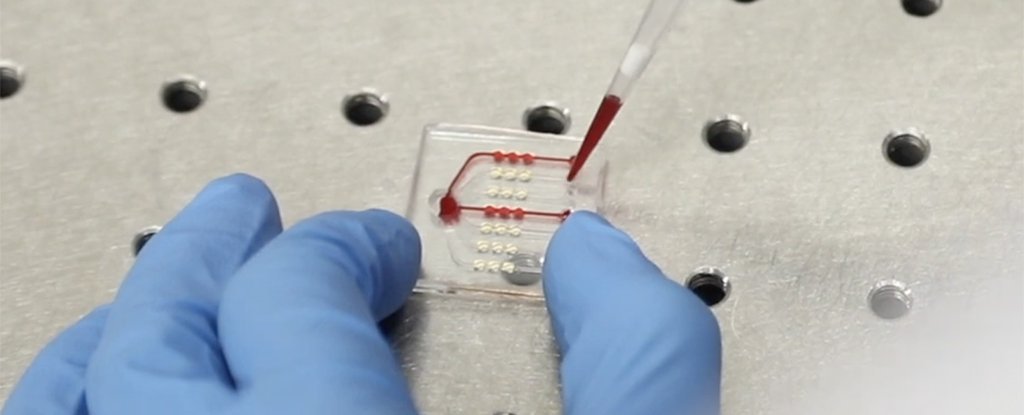 CancerJourneys's tweet photo. For The First Time, a Blood Test Can Tell if Cancer Treatment Is Working Right Away https://t.co/1CW0fVnqxC https://t.co/1EDnQBecUW