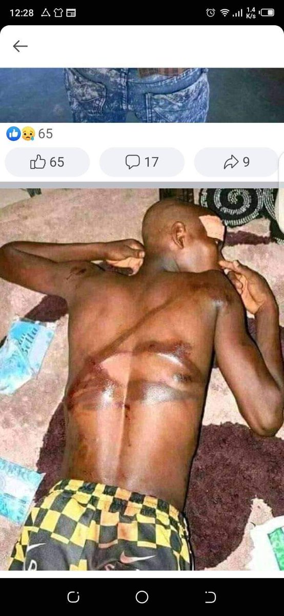 SsentongoBria14's tweet photo. @HouseofCommons @MattHancock @GavinWilliamson #PleaseUgandaisbleedingweneedhelpUNEuropeanUnionwhereareyou https://t.co/tPKUywox2s