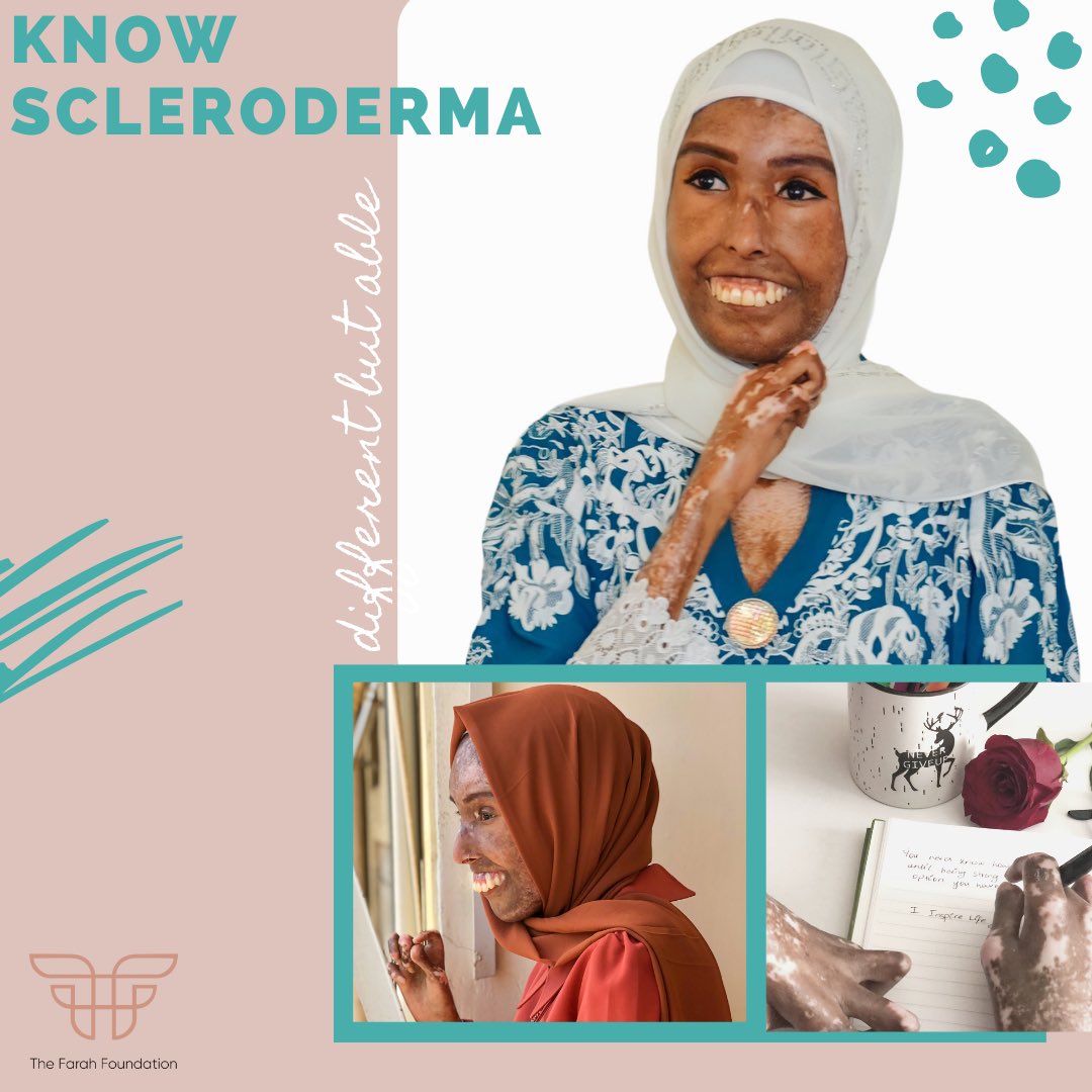 TheFarahFdn's tweet image. Spreading awareness about Scleroderma and other autoimmune disorders is my goal and I am only just beginning. 
#knowscleroderma #sclerodermaawarenessmonth