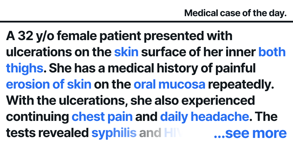 lepius_io's tweet photo. Looking for a place to discuss rare disease diagnosis?
Try Lepius for free! https://t.co/STuwnEgOlp

#lepius #hospital #doctor #clinical #medical #medicaldoctor #medicalstudent #pulmonology #medicaldoctors #immunology #neurology #dermatology #raredisease #behcetdisease https://t.co/pPK6fD3Xao