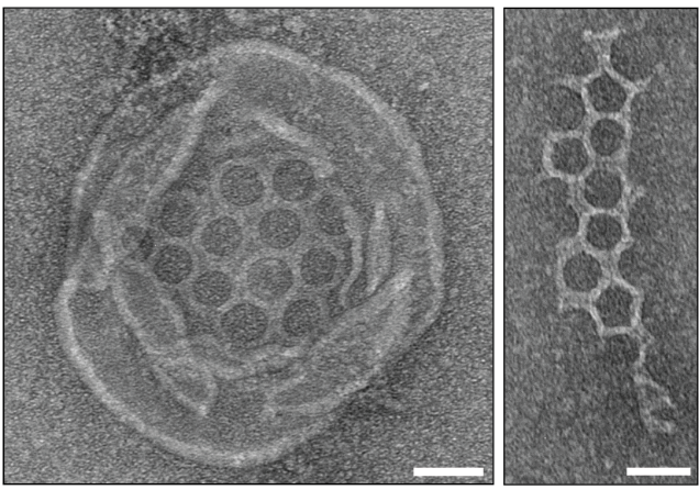 jamesknunez's tweet photo. The Kranzusch train keeps rolling. Similar to human cells, bacteria possess gasdermin proteins to signal regulated cell death by forming mesh-like pores on the cell membrane. Super cool discovery!

https://t.co/c9XsEZlTxD https://t.co/BeBmqXAtON