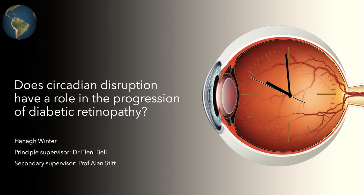 HanaghWinter's tweet photo. So excited to have won joint first prize at the @WWIEM_QUB 1st Year PhD symposium! Thank you to my supervisors @belielen and @Alanretina 
Thank you also to the symposium committee for organising a great day and well done to everyone who presented! #DiabeticRetinopathy #circadian https://t.co/qpKERDRmp3