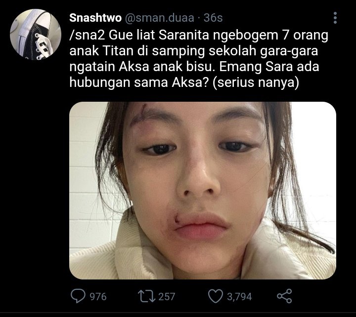 buminyakala's tweet photo. : AKSARANITA 

      Tw // disability .

Alternative Universe. https://t.co/YMOcNOyDEb