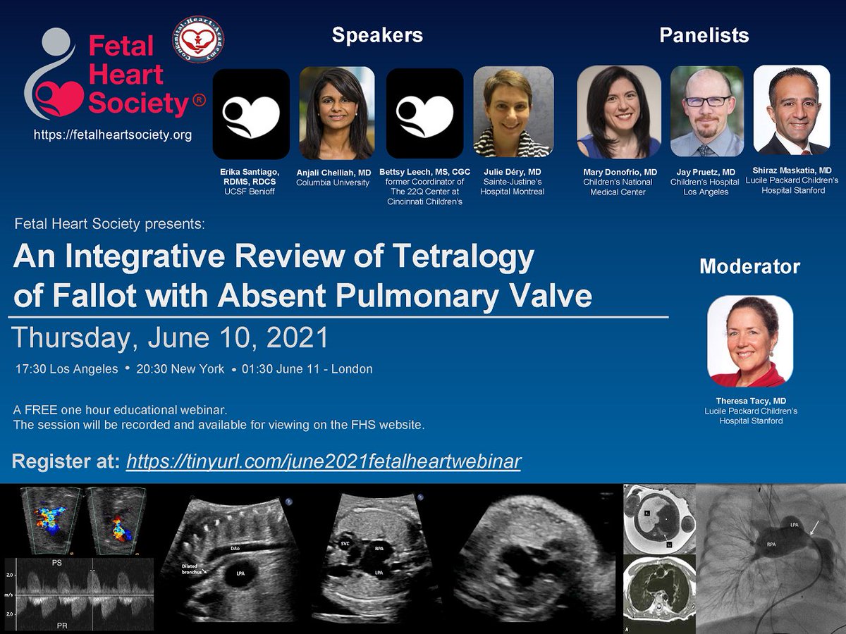 Jon us! Our next educational webinar this -&gt; Thursday, June 10th, 2021 at 8:30 pm EST on An Integrative Review of Tetralogy of Fallot with Absent Pulmonary Valve. Registration and details: 
tinyurl.com/June10Web