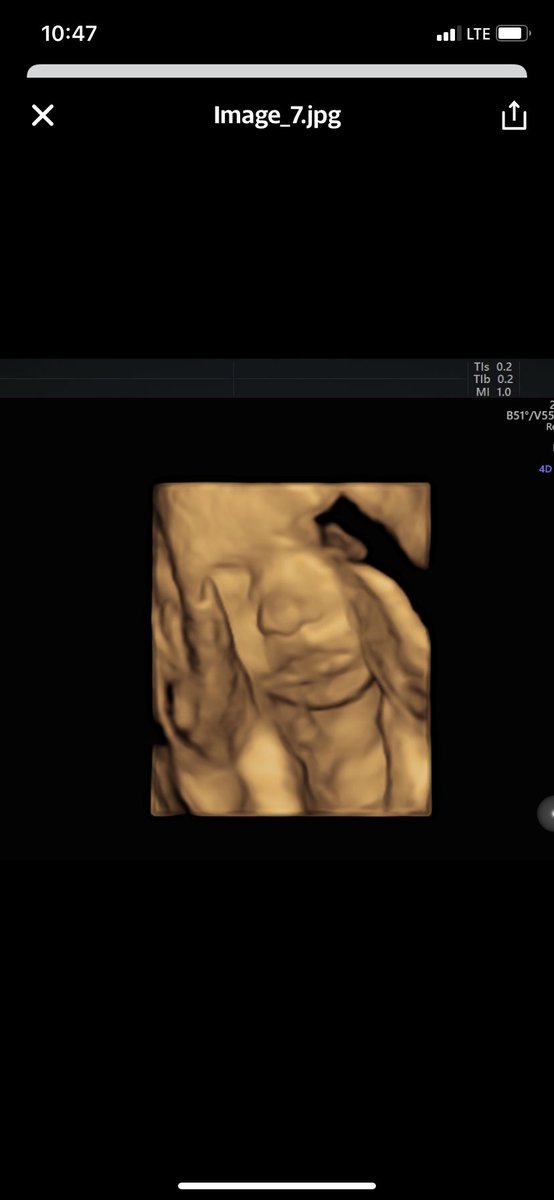 _kariwalker's tweet photo. Already so in love with this baby girl 🥺💕 https://t.co/cJRXg3Usar