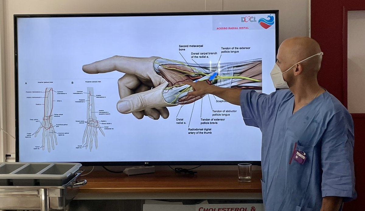 EIdeOliveiraMD's tweet photo. Another great D@CL edition on distal radial access with @VinhasHugo and his outstanding team (Faro, Portugal) @APIC_pt @spcardio @rpcardiologia @EAPCIPresident #APIC #YoungEAPCI @CarlosGalvoBra1 @RitaCal3 @PAGoncalves_ @brmelica @JoanaDelgadoSi1 https://t.co/zhx5PraVhK