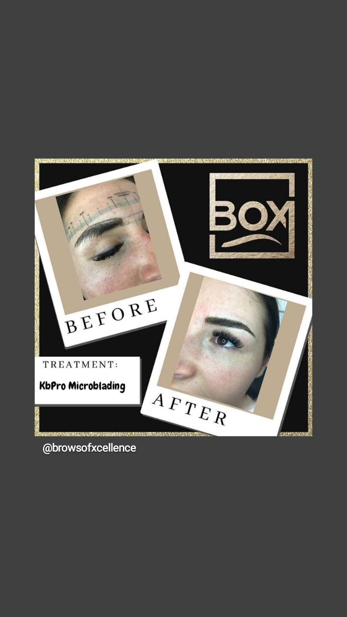 Brows_Xcellence's tweet photo. #BeforeandAfter another happy client at #BrowsofXcellence #Essex #Microblading #kbpro #kbprobrows 😍 #RT https://t.co/gXqHLr59px