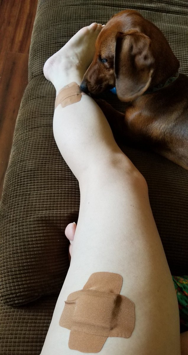 JodieLynne_517's tweet photo. When things happen and you have such a good caretaker, you decide to take that sick time after all and enjoy the great company.
#theNotSoSexyLegPic
#gettingolderproblems
#SlinkyDogMoka https://t.co/9ZykKfs9Yt