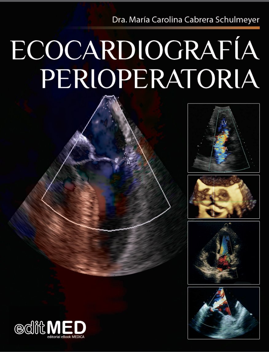 chileanestesia's tweet photo. Queridos amig@s y amigos!! El curso POCUS incluye además material de apoyo!!!! ebook de eco perioeratorio NO LO PUEDES PERDER!!! https://t.co/lT6jzc9Bl7 NO TE QUEDES SIN TU CUPO!! https://t.co/gMwOqk3oVj