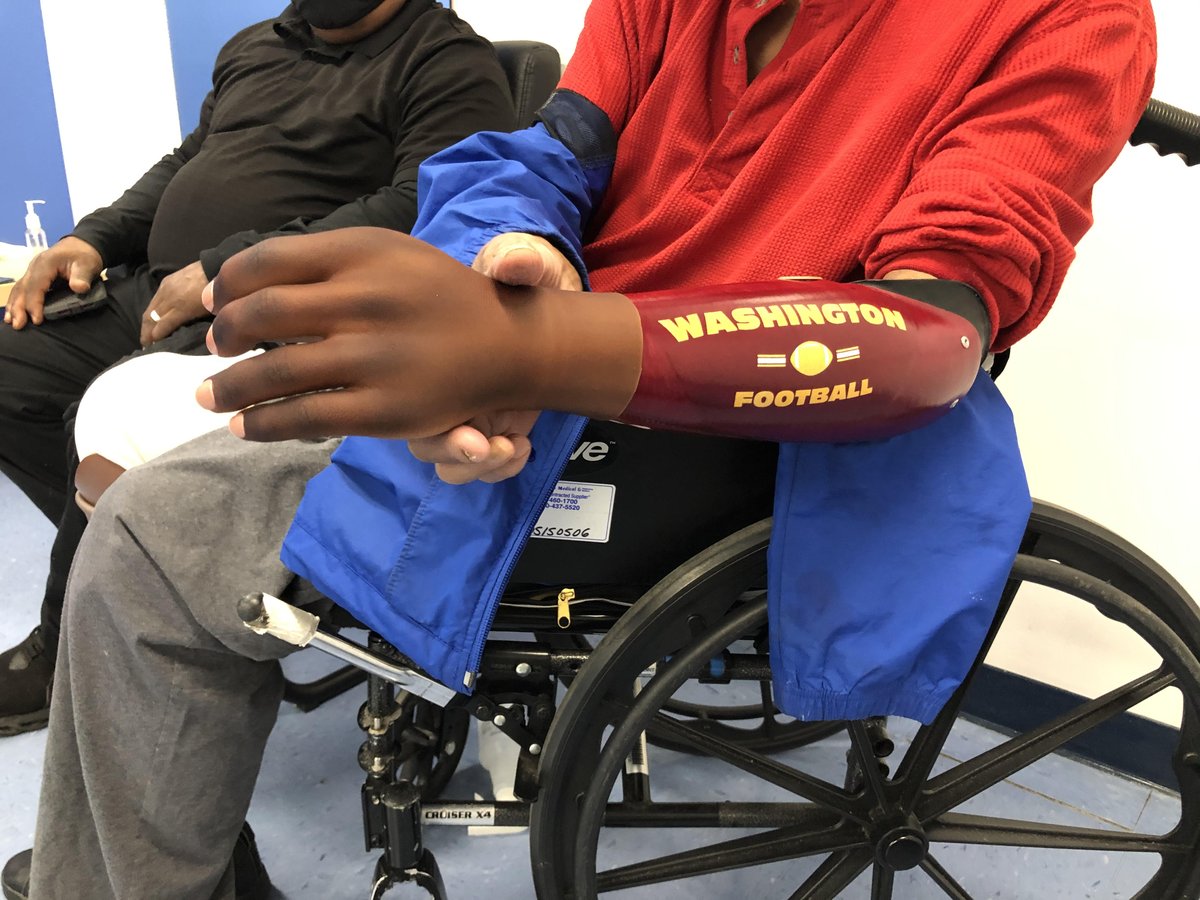 MedicalCenterOP's tweet photo. We were so thrilled to deliver this prosthetic arm, we just had to share it 🦾🦾
#moveforward #moveforwardmcop #mcop #livelife #inspiration #overcome #yesican #adaptive #iamadaptive #medicaldevices #amputees #prosthetichand #amputee #washingtonfootball #washingtonfootballteam https://t.co/jz7looBl57