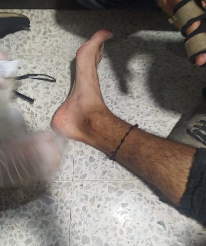 equipojuridico's tweet photo. #DerechosHumanos | 27 PERSONAS HERIDAS POR EL ESMAD EN BUCARAMANGA ¿QUIÉN DIO LA ORDEN?

📲 https://t.co/zmqJDu7fwg https://t.co/1adIDKNVXS