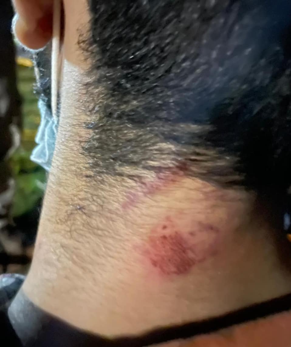 equipojuridico's tweet photo. #DerechosHumanos | 27 PERSONAS HERIDAS POR EL ESMAD EN BUCARAMANGA ¿QUIÉN DIO LA ORDEN?

📲 https://t.co/zmqJDu7fwg https://t.co/1adIDKNVXS