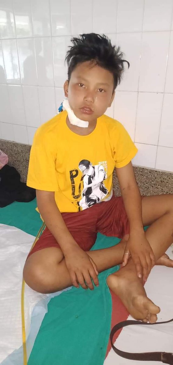 यि बाबुले धेरै दिन सम्म पानी पनि पिउन नपाउदा पानि दिनुस म आखिर मर्ने नै हो म पानी पिएरै मर्छु भन्नु भएको थियो रे म सारै रुएको थिए देखेकी त छैन तर पनि 😢 तर राम्रो हुनु भयो ज्यादै खुसी छौ 😘❤️🙏