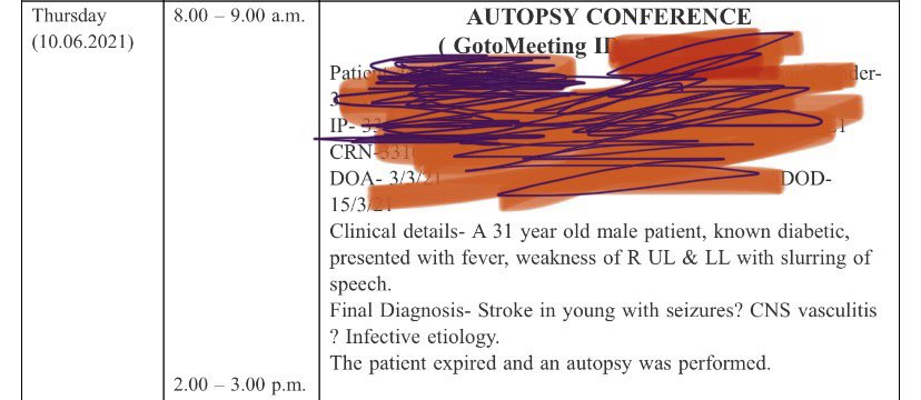 basalathullah7's tweet photo. @venkymd @indranilsays Sir, We have it at NIMS— Hyderabad. In fact, we just had a conference (virtual) today. Stroke in young...Moya moya disease on autopsy. https://t.co/jDnRV6Xbu9
