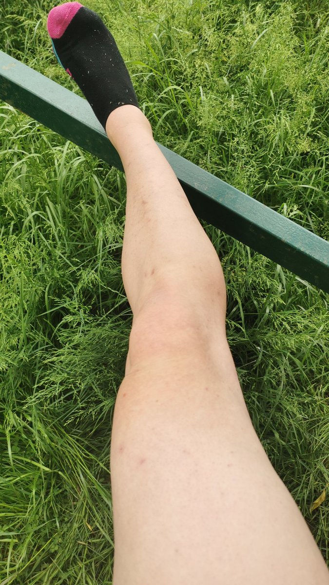 MikaJustMe's tweet photo. All shaved but gosh bushes on paths need a trim too ...#batteredlegs π€£π€£π€£π€£ https://t.co/S8ZxB1nQVZ
