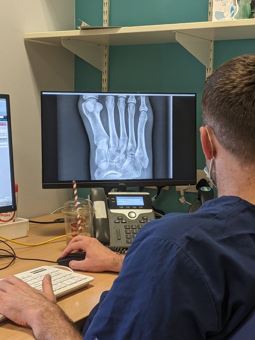 So this happened 🦶🏻💔 I broke my foot falling down the tube stairs on my way to a hot date 🤣  I wonder<a href="/tag/onlyfans"class="tags"><span>#onlyfans</span></a>