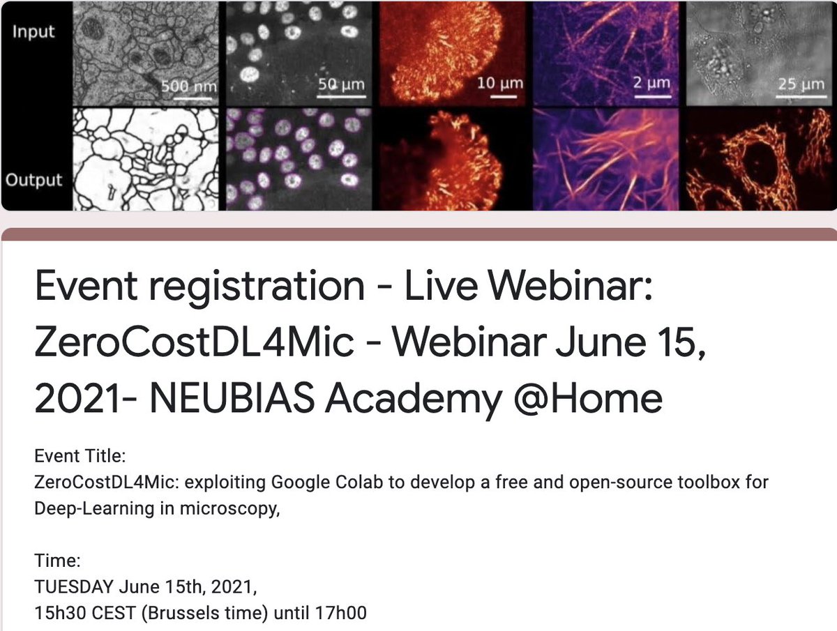 @NEUBIAS_COST - new webinar to happen on June 15th at 15h30-17h00 CEST (Brussels Time).
by @guijacquemet (ABO Academy, Turku) and @LaineBioImaging (UCL, London)

#Webinar #NEUBIAS_Academy #DeepLearning #Microscopy