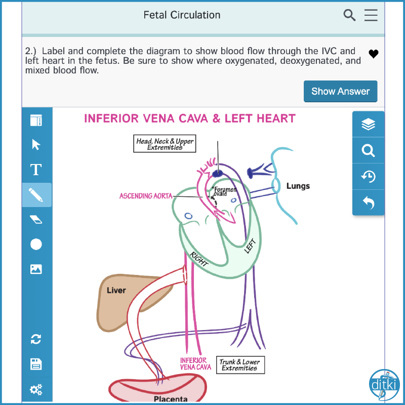 Ditki, Medical & Biological Sciences on X: Would you ratherread about  fetal circulation or draw it out? We'd choose drawing 100% of the time!  #ditki #meded #anatomy #embryology #humandevelopment #medicalschool  #nursing #pediatrics #
