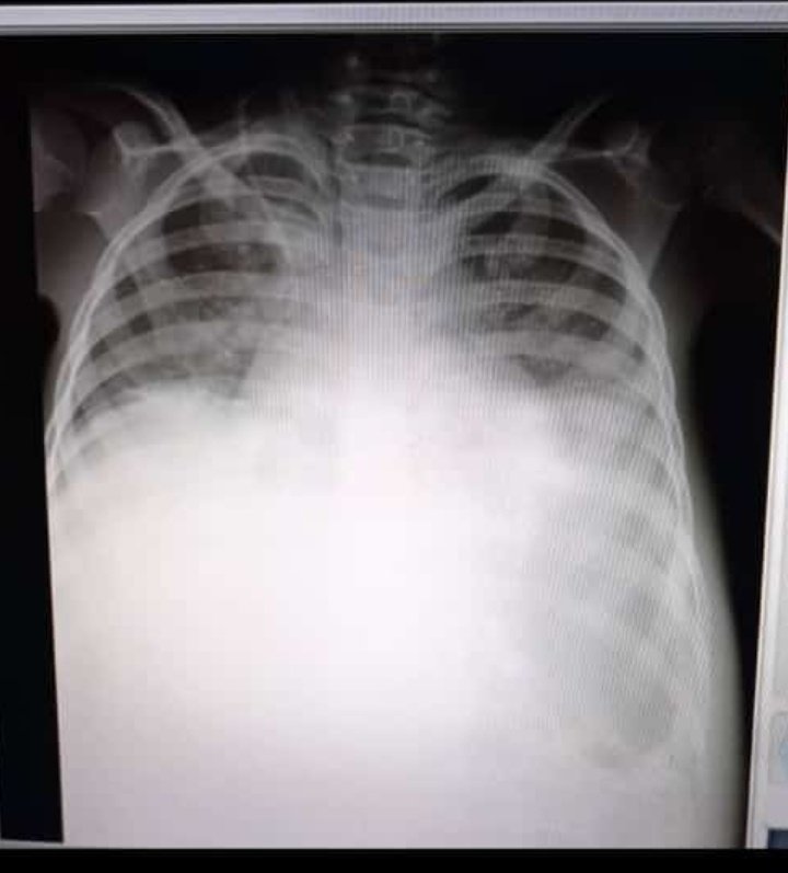 GioviInfante's tweet photo. Le e escrito a cualquier cantidad de fundación a influecer y e pasado por Twitter nombrando uno por uno hasta por Instagram, pero ninguno ni un RT ha hecho a la publicación. Debe ser que no le funciona ayudar de verdad sin ningún interés 😠 todo en esta vida tiene algún interés https://t.co/0qz3SA4LJt